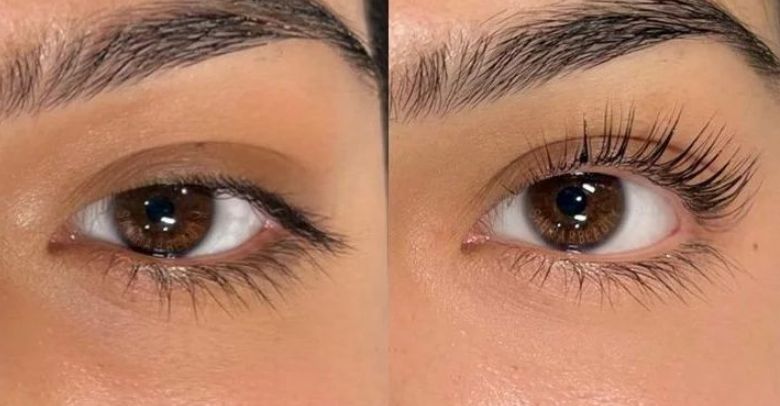 Lifting a laminace řas - Žebříček sad